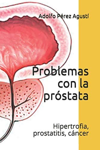 Problemas con la próstata: Hipertrofia, prostatitis, cáncer: 20 (Tratamiento natural)