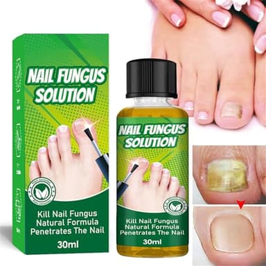 Cuidado de hongos en las uñas de los pies, curado de uñas para uñas de los pies, extra fuerte, 30 ml, tratamiento antihongos en las uñas de los pies